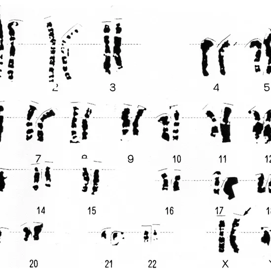 Chromosomal Analysis